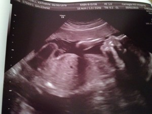 photo-11